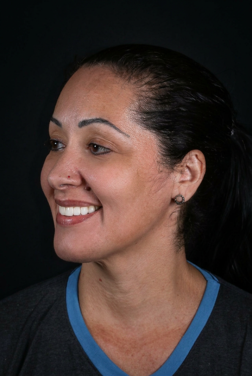Sorriso natural de paciente da Paiano Odontologia